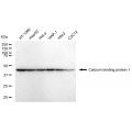 LifeSab™ CABP1 Rabbit mAb (20 μl)