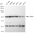 LifeSab™ CaMKII Rabbit mAb (20 μl)