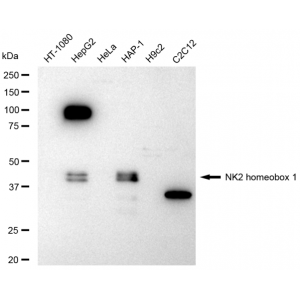 LifeSab™ TTF-1 Rabbit mAb (20 μl)