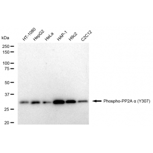 LifeSab™ Phospho-PP2A alpha (Y307) Rabbit mAb (20 μl)