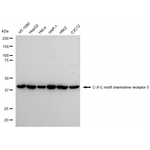 LifeSab™ CD185 Rabbit mAb (20 μl)