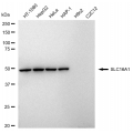 LifeSab™ SLC16A1 Rabbit mAb (20 μl)