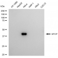 LifeSab™ SPOP Rabbit mAb (20 μl)