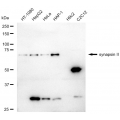 LifeSab™ SYN2 Rabbit mAb (20 μl)