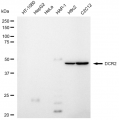 LifeSab™ DCR2 Rabbit mAb (20 μl)