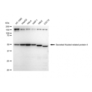 LifeSab™ SFRP4 Rabbit mAb (20 μl)