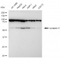 LifeSab™ SYN2 Rabbit mAb (20 μl)