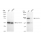 LifeSab™ KD-Validated ACAP2 Rabbit mAb (20 μl)