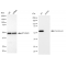 LifeSab™ KD-Validated CRT Rabbit mAb (20 μl)