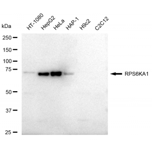 LifeSab™ KD-Validated RPS6KA1 Rabbit mAb (20 μl)