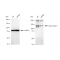 LifeSab™ KD-Validated JAK1 Rabbit mAb (20 μl)