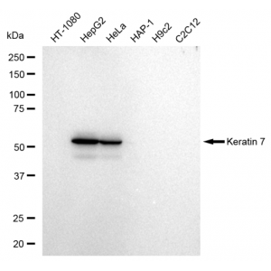 LifeSab™ KD-Validated K7 Rabbit mAb (20 μl)