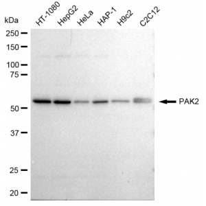 LifeSab™ KD-Validated PAK2 Rabbit mAb (20 μl)