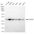 LifeSab™ KD-Validated CHMP2B Rabbit mAb (20 μl)