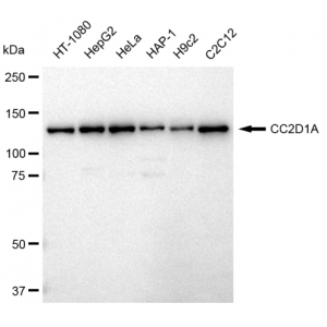 LifeSab™ KD-Validated CC2D1A Rabbit mAb (20 μl)