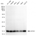 LifeSab™ KD-Validated AP2S1 Rabbit mAb (20 μl)