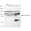 LifeSab™ KD-Validated CTNND1 Rabbit mAb (20 μl)