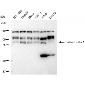 LifeSab™ KD-Validated CTNND1 Rabbit mAb (20 μl)