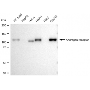 LifeSab™ KD-Validated AR Rabbit mAb (20 μl)