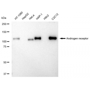 LifeSab™ KD-Validated AR Rabbit mAb (20 μl)