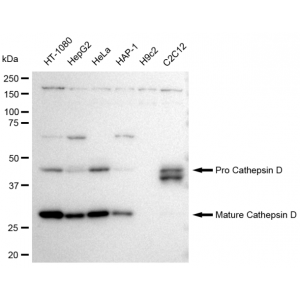 LifeSab™ KD-Validated CTSD Rabbit mAb (20 μl)