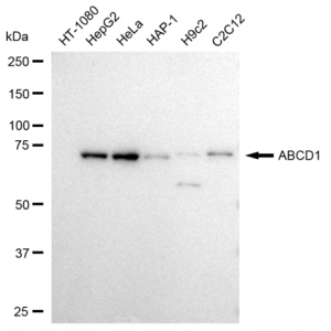 LifeSab™ KD-Validated ABCD1 Rabbit mAb (20 μl)