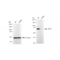 LifeSab™ KD-Validated ABCD1 Rabbit mAb (20 μl)