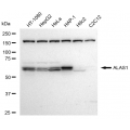 LifeSab™ KD-Validated ALAS1 Rabbit mAb (20 μl)