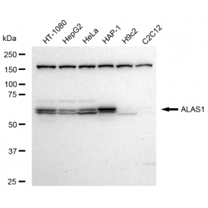 LifeSab™ KD-Validated ALAS1 Rabbit mAb (20 μl)