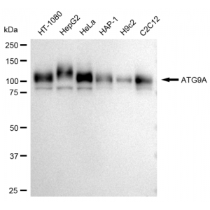 LifeSab™ KD-Validated ATG9A Rabbit mAb (20 μl)