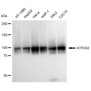 LifeSab™ KD-Validated ATP2A2 Rabbit mAb (20 μl)