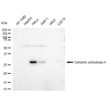 LifeSab™ KD-Validated CA2 Rabbit mAb (20 μl)