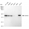 LifeSab™ KD-Validated ABHD5 Rabbit mAb (20 μl)