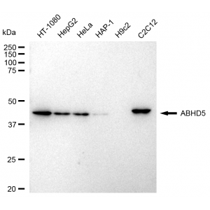 LifeSab™ KD-Validated ABHD5 Rabbit mAb (20 μl)