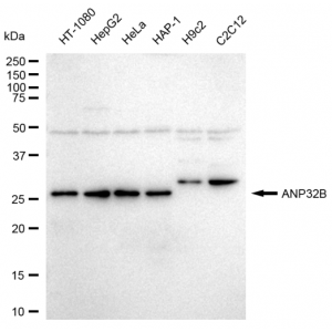 LifeSab™ KD-Validated ANP32B Rabbit mAb (20 μl)