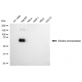 LifeSab™ KD-Validated ALPI Rabbit mAb (20 μl)