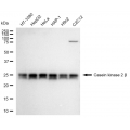 LifeSab™ KD-Validated CSNK2B Rabbit mAb (20 μl)