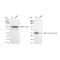 LifeSab™ KD-Validated CSNK2B Rabbit mAb (20 μl)