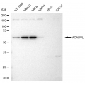 LifeSab™ KD-Validated ACADVL Rabbit mAb (20 μl)