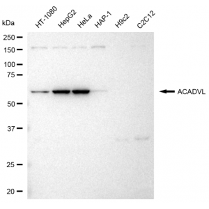 LifeSab™ KD-Validated ACADVL Rabbit mAb (20 μl)