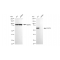 LifeSab™ KD-Validated ACADVL Rabbit mAb (20 μl)