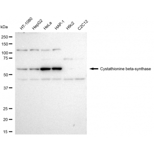 LifeSab™ KD-Validated CBS Rabbit mAb (20 μl)