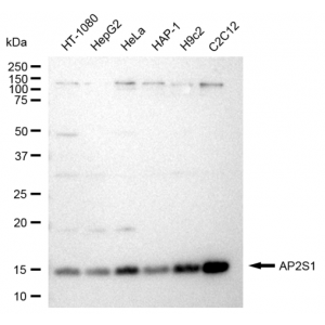 LifeSab™ KD-Validated AP2S1 Rabbit mAb (20 μl)