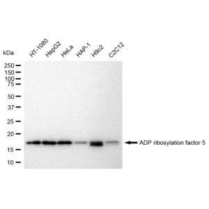 LifeSab™ KD-Validated ARF5 Rabbit mAb (20 μl)