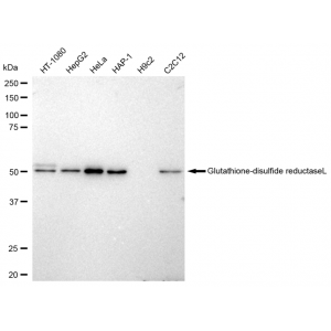 LifeSab™ KD-Validated GSR Rabbit mAb (20 μl)