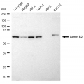 LifeSab™ KD-Validated LMNB2 Rabbit mAb (20 μl)