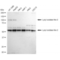 LifeSab™ KD-Validated LOXL2 Rabbit mAb (20 μl)