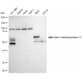 LifeSab™ KD-Validated MMP14 Rabbit mAb (20 μl)