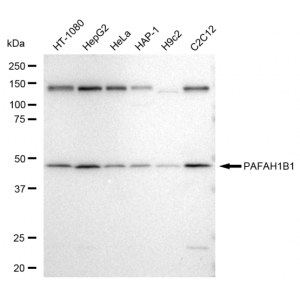 LifeSab™ KD-Validated PAFAH1B1 Rabbit mAb (20 μl)