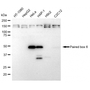 LifeSab™ KD-Validated Paired box 6 Rabbit mAb (20 μl)